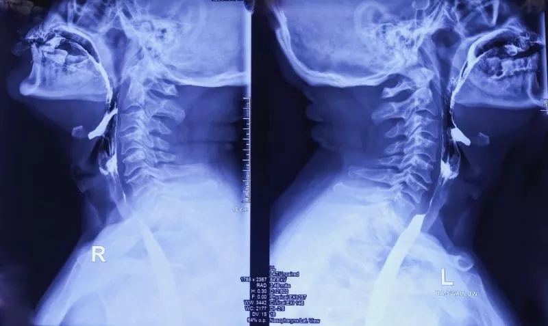 SimonMed leads the largest global study of AI in X-ray