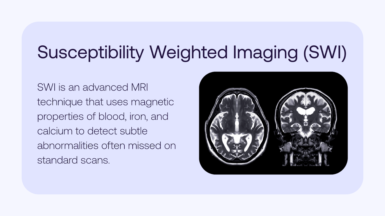 Susceptibility weighted imaging (SWI) brain MRI showing detailed scan of brain structures